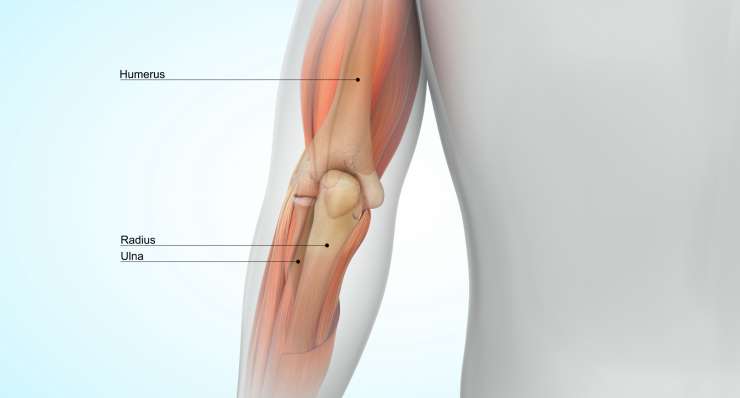 Ellenbogeninstabilität Ellenbogeninstabilität - Folge von Band- oder Kapselverletzungen. Behandlung in München durch Prof. Dr. med. Martetschläger